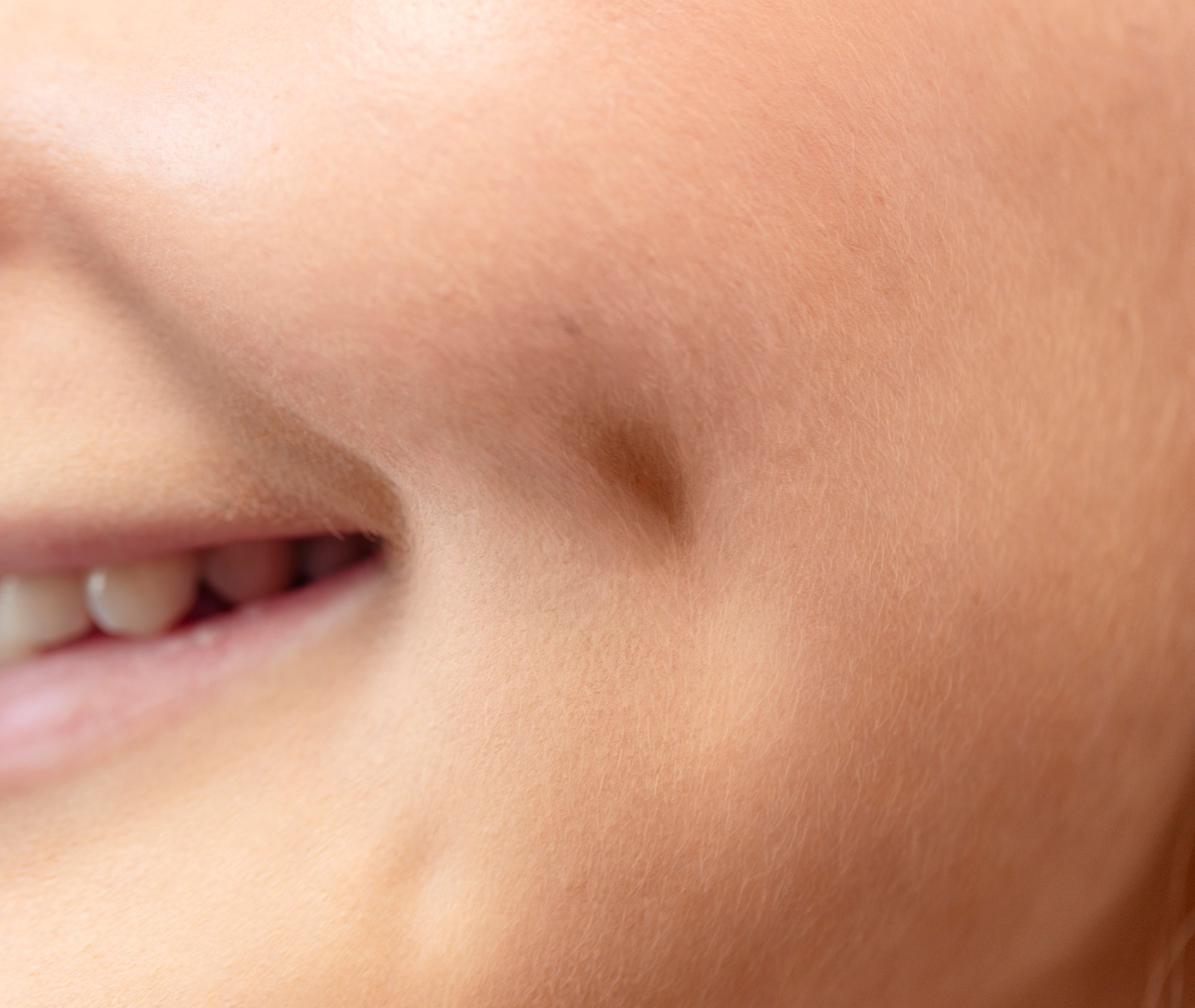 aliva_smilehull copy